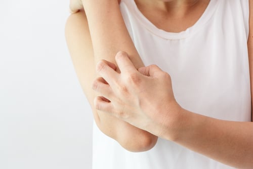 Unusual Symptoms of Rheumatoid Arthritis